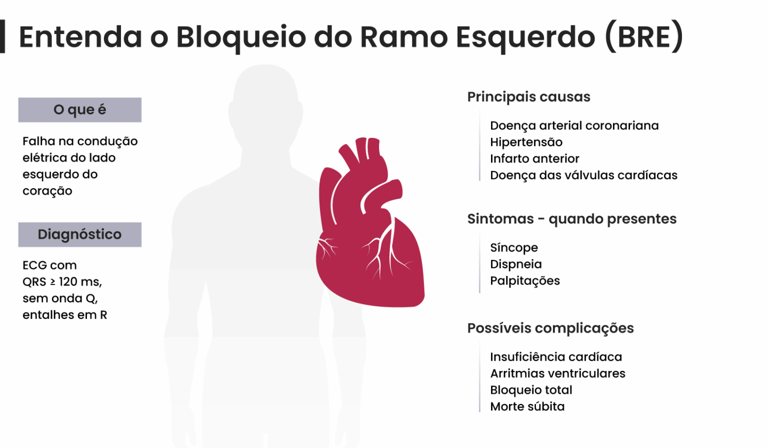 Bloqueio Do Ramo Esquerdo Sintomas Causas E Tratamento Neomed