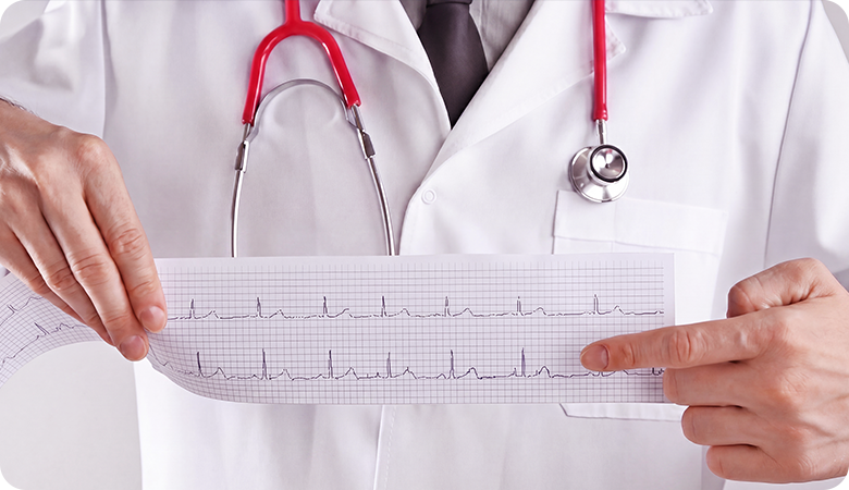 Onda U no eletrocardiograma: entenda o que ela indica