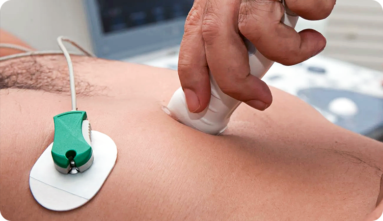 Exames cardiológicos e procedimentos cardiovasculares: quando indicar